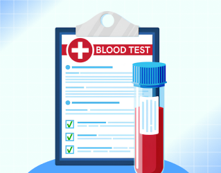 Blood Tests Before Diet: How to Read Your Lab Results now