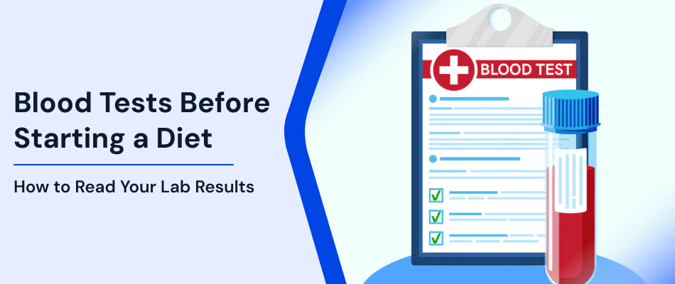 Blood Tests Before Diet: How to Read Your Lab Results now